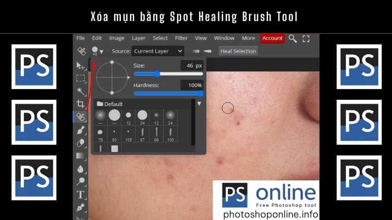 Xóa mụn bằng Spot Healing Brush Tool