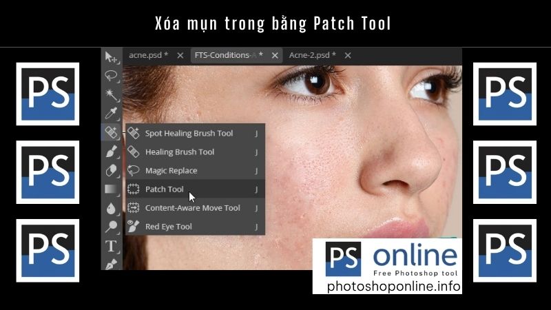 Xóa mụn trong bằng Patch Tool