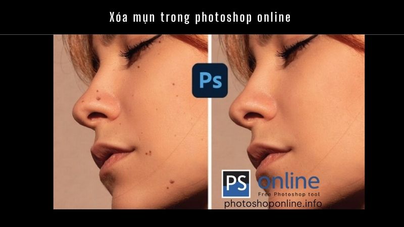 Xóa mụn trong photoshop