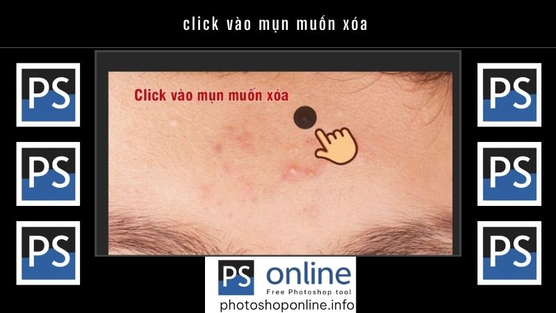 click vào mụn muốn xóa